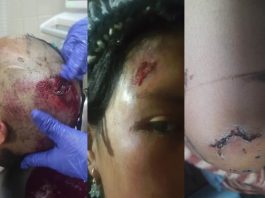 El testimonio de Iván Rolando Chagnama Chimbo, vendedor ambulante indígena y hablante de kichwa, revela un patrón sostenido de agresiones, discriminación y persecución ejercido por agentes municipales en Quito. Su relato no solo describe hechos aislados, sino un contexto más amplio de vulnerabilidad estructural que afecta a cientos de comerciantes informales, especialmente pertenecientes a comunidades indígenas.