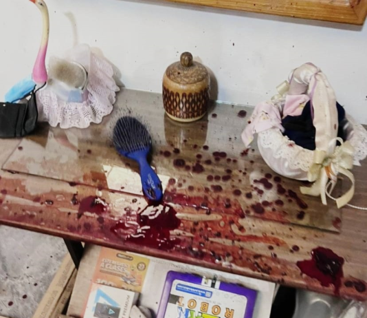 La tarde del 1 de diciembre de 2025, un incidente violento registrado dentro de una vivienda del barrio Los Pinos, en la intersección de las calles Los Arrayanes y Olivos, movilizó a unidades policiales, de emergencia y posteriormente a equipos de criminalística. El caso dejó un hombre fallecido y una mujer herida, y actualmente es investigado por la Fiscalía debido a la complejidad de la escena y la falta de una secuencia clara de los hechos.